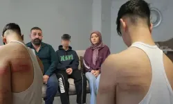 Kan donduran olay! Berberde 2 çırağı demir sopa ve süpürge sapıyla dövdü