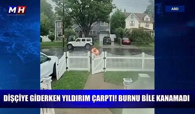 Dişçiye giderken yıldırım çarptı! Burnu bile kanamadı